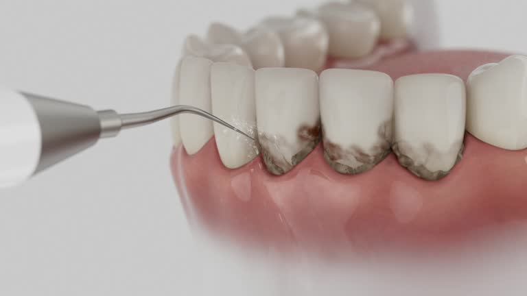 Trusted Invisalign Clear Aligners service in Garrettsville, OH - Dentist Open Now